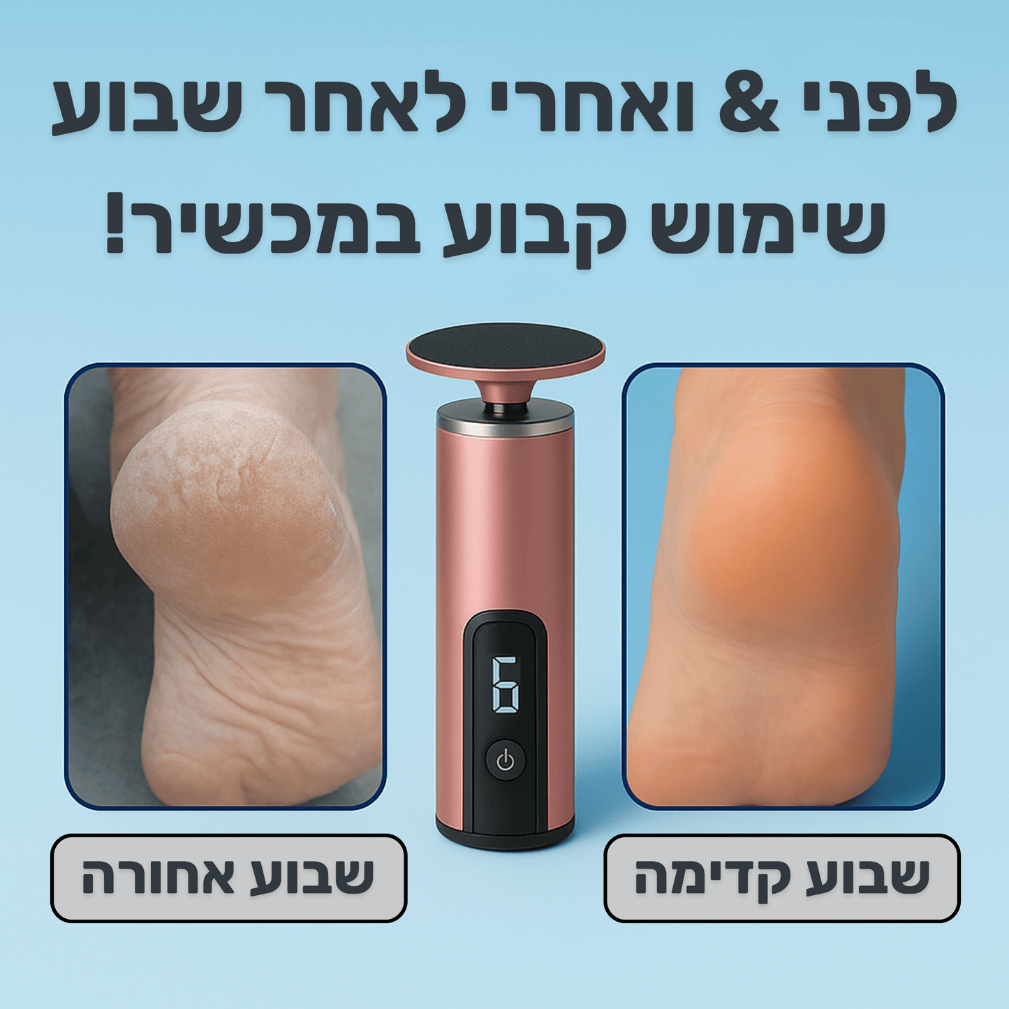 SORINA - פדיקור חשמלי